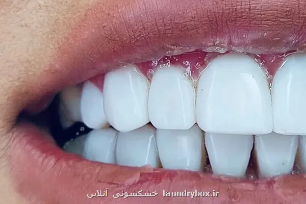 نگرانی های دندانپزشکی در حاملگی
